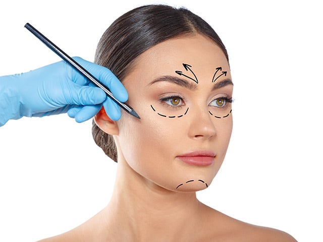 woman with dotted lines on face, cosmetology височный лифтинг